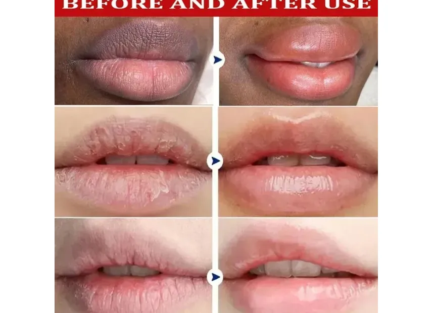 Remove Dark Lip Balm Lightening Melanin Mask Gloss Oil Exfoliating Clean Moisturizer Korean Care Products Makeup Beauty Health